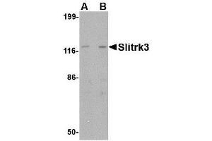 Image no. 1 for anti-SLIT and NTRK-Like Family, Member 3 (SLITRK3) (C-Term) antibody (ABIN1493367) (SLITRK3 antibody  (C-Term))