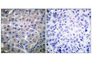 Immunohistochemistry (IHC) image for anti-Breast Cancer Anti-Estrogen Resistance 1 (BCAR1) (Tyr410) antibody (ABIN1847917) (BCAR1 antibody  (Tyr410))