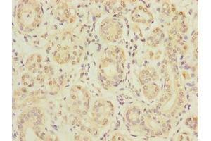 Immunohistochemistry of paraffin-embedded human salivary gland tissue using ABIN7170019 at dilution of 1:100 (SLC5A1 antibody  (AA 239-288))