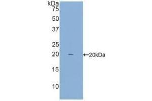 Detection of Recombinant IFNg, Rabbit using Polyclonal Antibody to Interferon Gamma (IFNg) (Interferon gamma antibody  (AA 24-167))