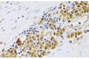 Immunohistochemistry of paraffin-embedded Human esophagus using PA2G4 Polyclonal Antibody at dilution of 1:100 (40x lens). (PA2G4 antibody)