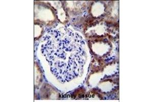 CASP3 Antibody (C-term) (ABIN655271 and ABIN2844863) immunohistochemistry analysis in formalin fixed and paraffin embedded human kidney tissue followed by peroxidase conjugation of the secondary antibody and DAB staining. (Caspase 3 antibody  (C-Term))