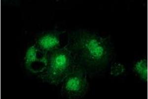 Anti-GSS mouse monoclonal antibody (ABIN2453904) immunofluorescent staining of COS7 cells transiently transfected by pCMV6-ENTRY GSS (RC203174). (Glutathione Synthetase antibody)