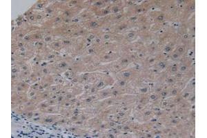 IHC-P analysis of Human Liver Tissue, with DAB staining. (NFkB antibody  (AA 805-892))