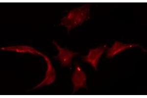 ABIN6275333 staining HuvEc by IF/ICC. (SLC22A3 antibody  (Internal Region))