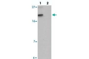 Western blot analysis of SPINK2 in mouse heart tissue with SPINK2 polyclonal antibody  at 1 ug/mL in (lane 1) the absence and (lane 2) the presence of blocking peptide. (SPINK2 antibody  (C-Term))