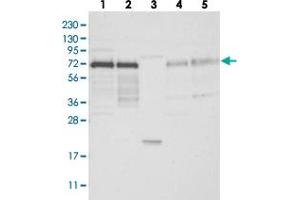 Western blot analysis of Lane 1: RT-4, Lane 2: U-251 MG, Lane 3: Human Plasma, Lane 4: Liver, Lane 5: Tonsil with IRF2BP2 polyclonal antibody  at 1:250-1:500 dilution. (IRF2BP2 antibody)