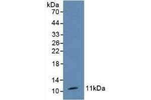 Detection of TFF1 in Mouse Kidney Tissue using Polyclonal Antibody to Trefoil Factor 1 (TFF1) (TFF1 antibody  (AA 1-87))