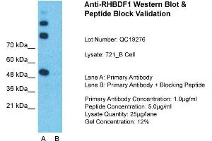 Host:  Rabbit  Target Name:  RHBDF1  Sample Type:  721_B Whole Cell  Lane A:  Primary Antibody  Lane B:  Primary Antibody + Blocking Peptide  Primary Antibody Concentration:  1ug/ml  Peptide Concentration:  5ug/ml  Lysate Quantity:  25ug/lane/Lane  Gel Concentration:  0. (RHBDF1 antibody  (N-Term))