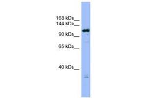 Image no. 1 for anti-HAUS Augmin-Like Complex, Subunit 6 (HAUS6) (C-Term) antibody (ABIN6742147) (FAM29A antibody  (C-Term))