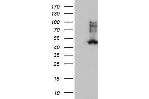 HEK293T cells were transfected with the pCMV6-ENTRY control (Left lane) or pCMV6-ENTRY FDFT1 (Right lane) cDNA for 48 hrs and lysed. (FDFT1 antibody)