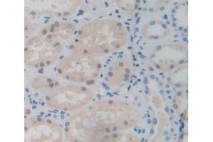 #VALUE! (Spindlin 1 antibody  (AA 1-262))