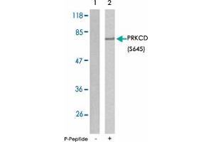 Western blot analysis of extracts from MCF7 using PRKCD (phospho S645) polyclonal antibody . (PKC delta antibody  (pSer645))