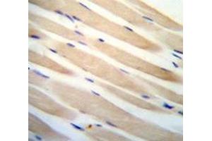 Immunohistochemistry analysis in human skeletal muscle using CHST3  Antibody , followed by peroxidase conjugation of the secondary antibody and DAB staining. (CHST3 antibody  (N-Term))