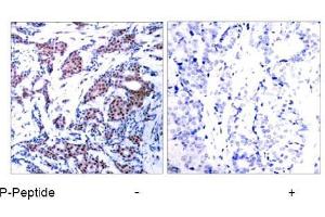 Image no. 1 for anti-Jun Proto-Oncogene (JUN) (pSer73) antibody (ABIN196612) (C-JUN antibody  (pSer73))