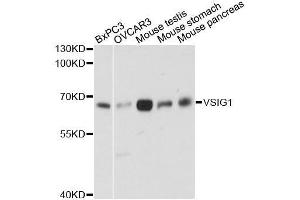 Western blot analysis of extracts of various cell lines, using VSIG1 antibody. (VSIG1 antibody  (AA 50-230))