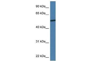 Western Blot showing ADIPOR2 antibody used at a concentration of 1 ug/ml against MDA-MB-435S Cell Lysate (Adiponectin Receptor 2 antibody  (N-Term))