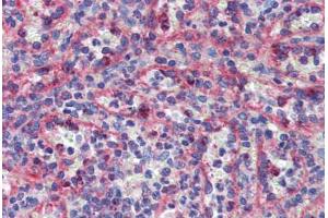 Spleen, Human: Formalin-Fixed, Paraffin-Embedded (FFPE) (KIF20A antibody  (C-Term))
