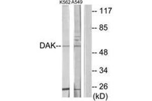 Western blot analysis of extracts from K562/A549 cells, using DAK Antibody.