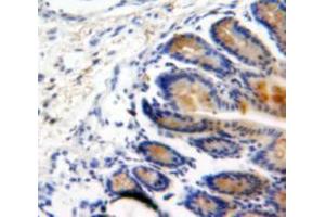 Used in DAB staining on fromalin fixed paraffin-embedded Intestine tissue (BMP2 antibody  (AA 24-396))