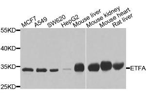 Western blot analysis of extracts of various cells, using ETFA antibody. (ETFA antibody)