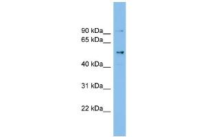 WB Suggested Anti-CCDC50 Antibody Titration: 0. (CCDC50 antibody  (Middle Region))