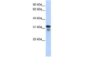 WB Suggested Anti-LAPTM4B Antibody Titration:  0. (LAPTM4B antibody  (Middle Region))