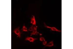 ABIN6274982 staining Hela cells by IF/ICC. (CDC42EP5 antibody  (N-Term))
