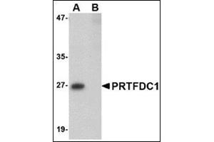 Western blot analysis of PRTFDC1 in human brain tissue lysate with this product at 1 μg/ml in the (A) absence and (B) presence of blocking peptide.
