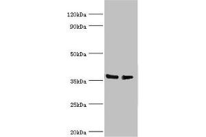 Western blot All lanes: HNRNPD antibody at 4 μg/mL Lane 1: Hela whole cell lysate Lane 2: 293T whole cell lysate Secondary Goat polyclonal to rabbit IgG at 1/10000 dilution Predicted band size: 39, 37, 33, 31 kDa Observed band size: 39 kDa (HNRNPD/AUF1 antibody  (AA 1-306))