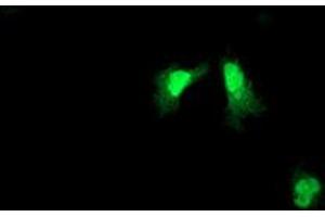 Image no. 2 for anti-ADP-Ribosylation Factor-Like 11 (ARL11) antibody (ABIN1496714) (ARL11 antibody)