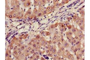 Immunohistochemistry of paraffin-embedded human liver tissue using ABIN7144667 at dilution of 1:100 (AADAC antibody  (AA 24-399))
