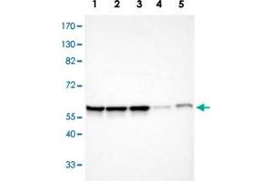 Western blot analysis of Lane 1: Human cell line RT-4; Lane 2: Human cell line U-251MG sp; Lane 3: Human cell line A-431; Lane 4: Human liver tissue; Lane 6: Human tonsil tissue with APEX1 polyclonal antibody  at 1:100-1:250 dilution.