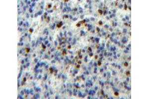 Used in DAB staining on fromalin fixed paraffin- embedded spleen tissue (ATG16L1 antibody  (AA 1-284))