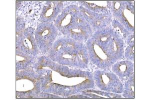 IHC analysis of NDEL1 using anti-NDEL1 antibody (ABIN7602511).