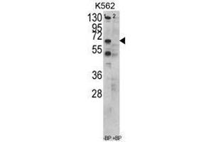 Image no. 1 for anti-Chaperonin Containing TCP1, Subunit 3 (Gamma) (CCT3) (C-Term) antibody (ABIN452830)