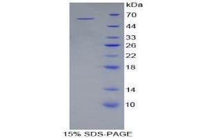 SDS-PAGE (SDS) image for Acid Phosphatase 5, Tartrate Resistant (ACP5) (AA 79-318) protein (His tag,GST tag) (ABIN2122346)