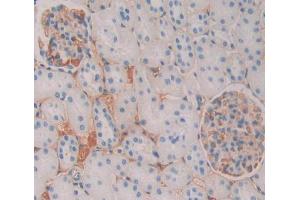 Used in DAB staining on fromalin fixed paraffin- embedded kidney tissue (CAMLG antibody  (AA 1-188))