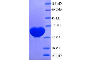 SDS-PAGE (SDS) image for GDSL Esterase/lipase 1 (GLIP1) (AA 22-232), (partial) protein (His tag) (ABIN5709585) (GDSL Esterase/lipase 1 (GLIP1) (AA 22-232), (partial) protein (His tag))