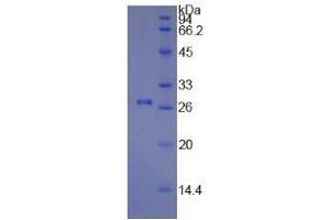 SDS-PAGE of Protein Standard from the Kit  (Highly purified E. (COL1A1 ELISA Kit)