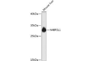 N4BP2L1 antibody  (AA 40-120)