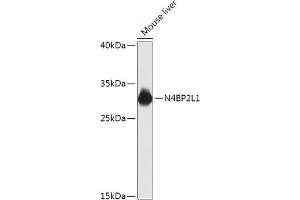 Western blot analysis of extracts of Mouse liver, using N4BP2L1 antibody (ABIN7268840) at 1:1000 dilution. (N4BP2L1 antibody  (AA 40-120))