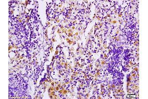 Formalin-fixed and paraffin embedded rat skin tissue tissue labeled with Anti PHOSPHO-MAP4K1(SER171) Polyclonal Antibody,Unconjugated (ABIN710396) at 1:200 followed by conjugation to the secondary antibody and DAB staining. (MAP4K1 antibody  (pSer171))