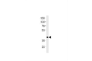 DANRE hoxd11a Antibody (Center) Azb10017a western blot analysis in zebra fish heart tissue lysates (35 μg/lane). (HOXD11 antibody  (AA 128-155))