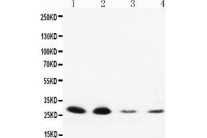 Anti-Neurotrophin 3 antibody, Western blotting Lane 1: Rat Brain Tissue Lysate Lane 2: Rat Brain Tissue Lysate Lane 3: MCF-7 Cell Lysate Lane 4: HELA Cell Lysate