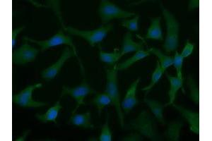 Immunofluorescent staining of HeLa cells using anti-UCK1 mouse monoclonal antibody (ABIN2453770). (UCK1 antibody)