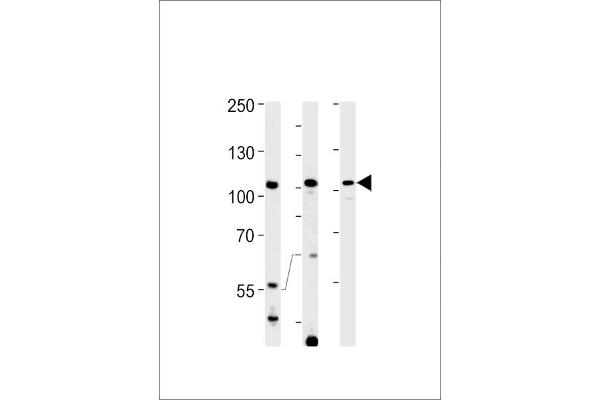 TFIP11 antibody  (N-Term)