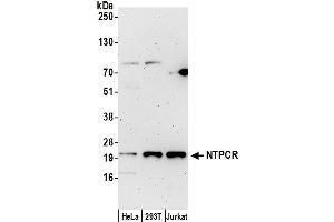 anti-Nucleoside-Triphosphatase, Cancer-Related (NTPCR) (AA 1-50) antibody