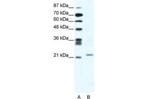 Western Blotting (WB) image for anti-Twist Homolog 1 (Drosophila) (TWIST1) antibody (ABIN2461623) (TWIST1 antibody)
