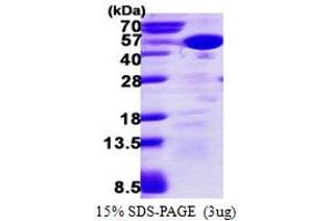 SDS-PAGE (SDS) image for Mitogen-Activated Protein Kinase 13 (MAPK13) (AA 1-365) protein (His tag) (ABIN667604) (MAPK13 Protein (AA 1-365) (His tag))